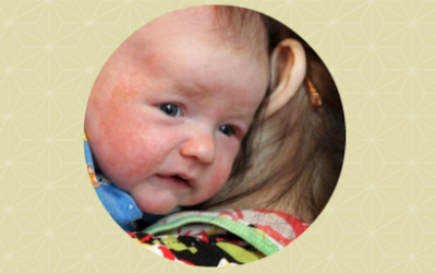 Darmtherapie voor baby per skype-consult